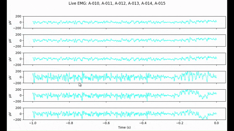 Live plotting of EMG channels with Intan